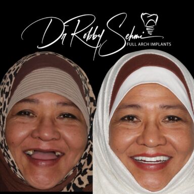 before-after2