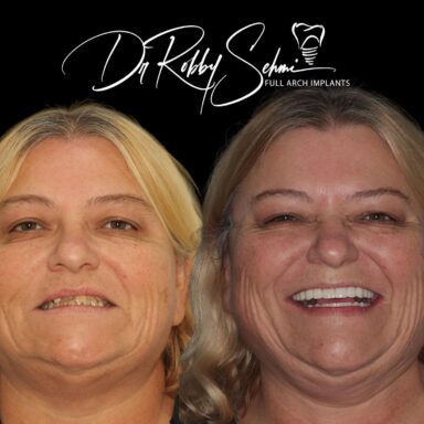 before-after3