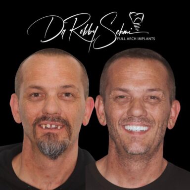 before-after4