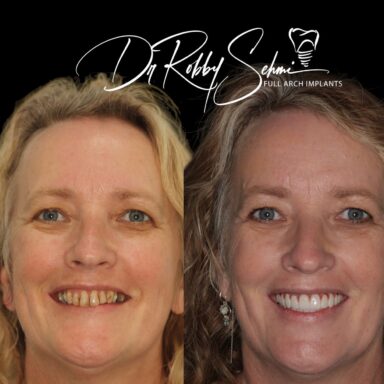 before-after5